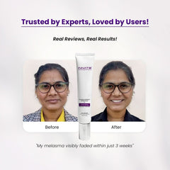 Clairis Correct Bright Max 21 – Advanced Pigmentation & Melasma Cream
Trusted by Experts, Loved by Users!
Real Reviews, Real Results!
 "My melasma visibly faded within just 3 weeks"