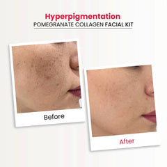 Innate Pomegranate Collagen Facial Kit With Sheet Mask